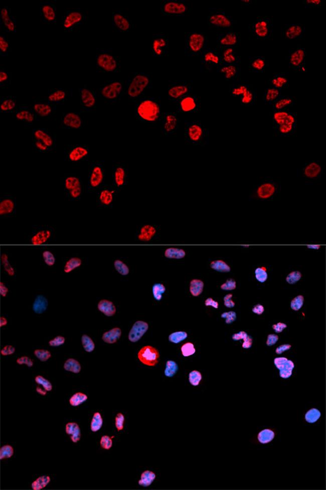 Phospho-CREB (Ser133) Antibody in Immunocytochemistry (ICC/IF)