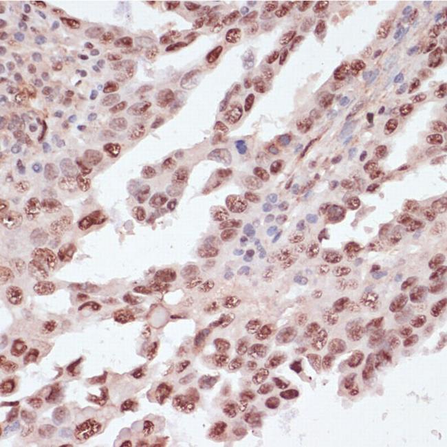 Phospho-ATF (Thr71) Antibody in Immunohistochemistry (Paraffin) (IHC (P))