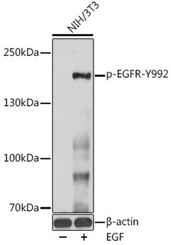 Phospho-EGFR (Tyr992) Antibody in Western Blot (WB)