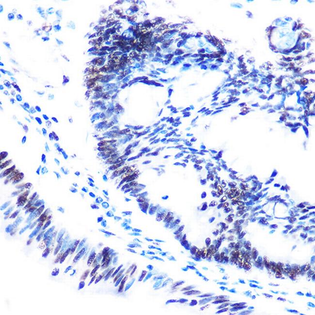 Phospho-SMC1 (Ser957) Antibody in Immunohistochemistry (Paraffin) (IHC (P))