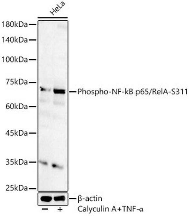 Phospho-NFkB p65 (Ser311) Antibody in Western Blot (WB)