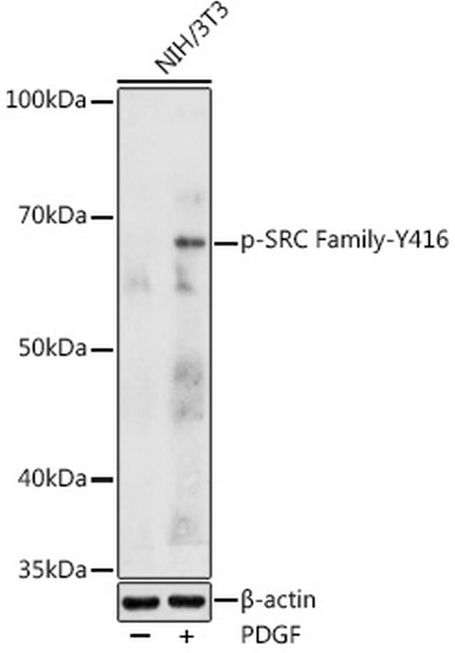 Phospho-SRC (Tyr416) Antibody in Western Blot (WB)