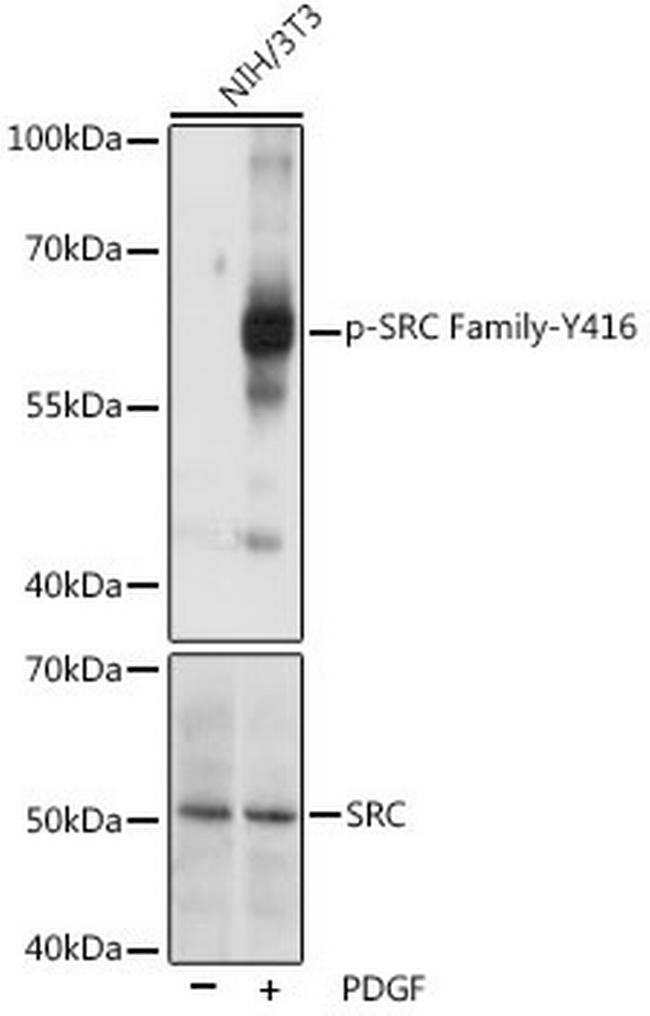 Phospho-SRC (Tyr416) Antibody in Western Blot (WB)