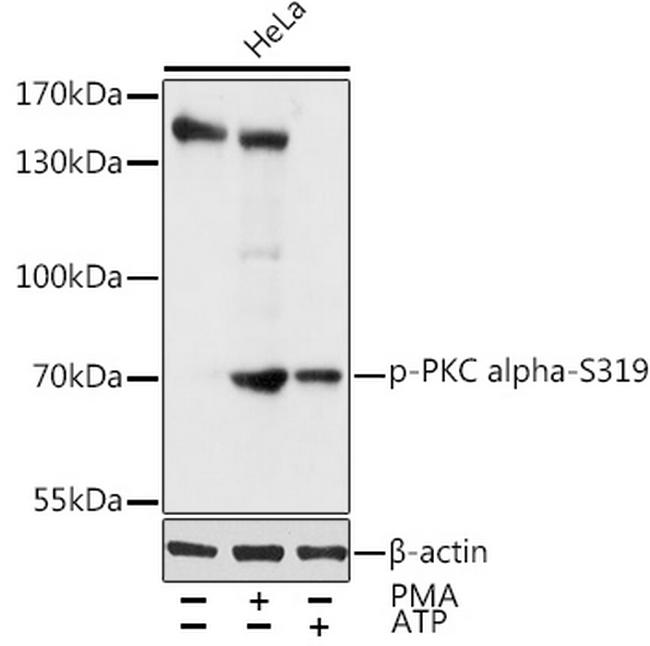 Phospho-PKC alpha (Ser319) Antibody in Western Blot (WB)