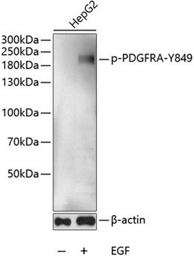 Phospho-PDGFRA (Tyr849) Antibody in Western Blot (WB)