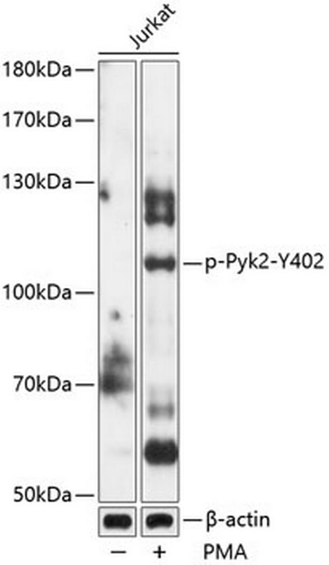 Phospho-PYK2 (Tyr402) Antibody in Western Blot (WB)