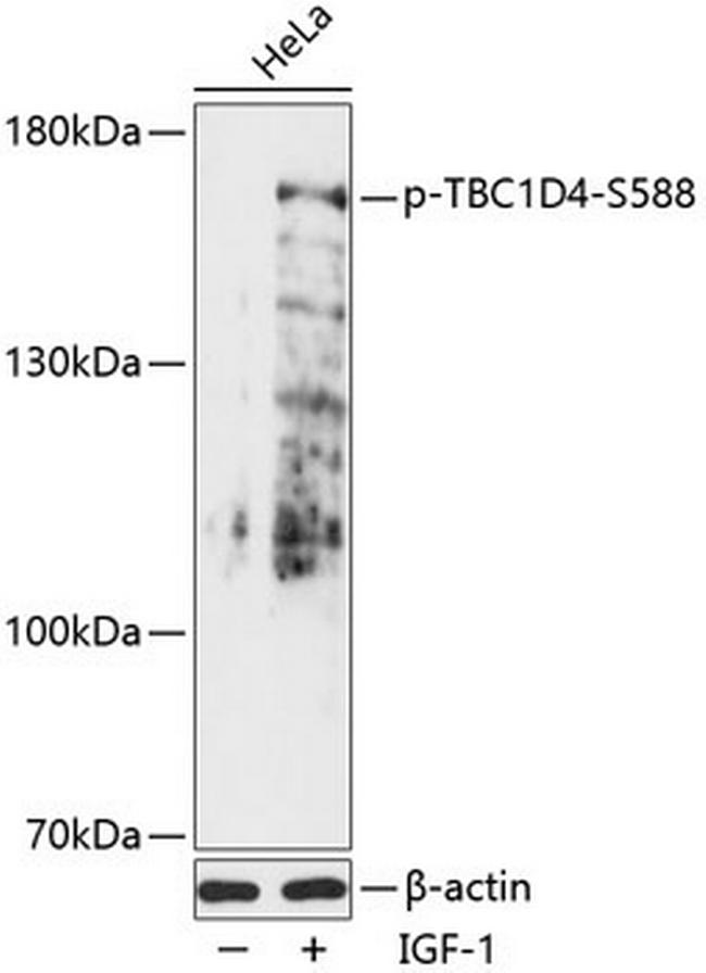 Phospho-AS160 (Ser588) Antibody in Western Blot (WB)