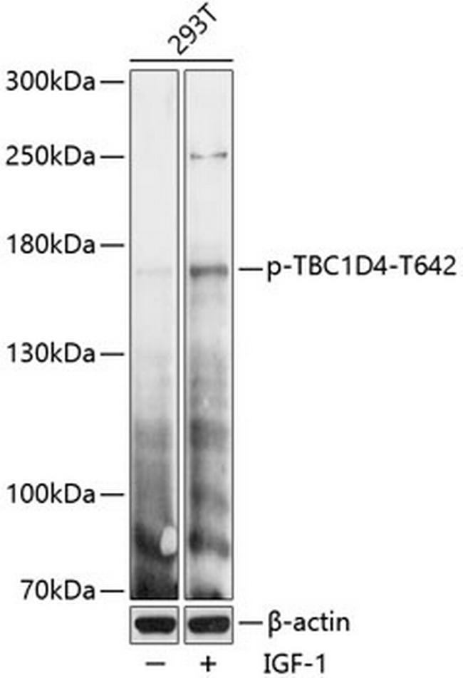 Phospho-AS160 (Thr642) Antibody in Western Blot (WB)