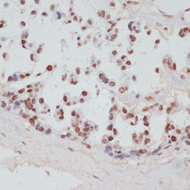 Phospho-MSK1 (Ser376) Antibody in Immunohistochemistry (Paraffin) (IHC (P))