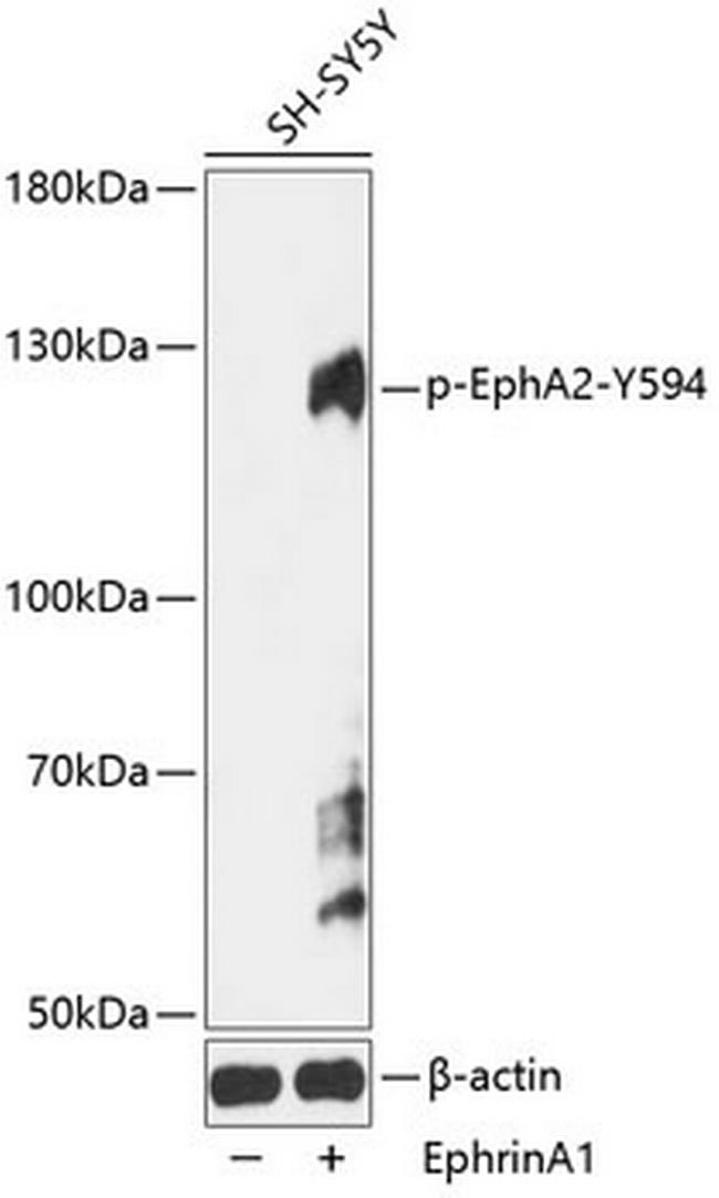 Phospho-EphA2 (Tyr594) Antibody in Western Blot (WB)