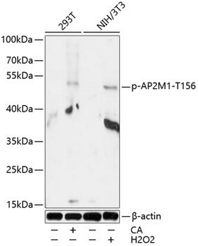 Phospho-AP2M1 (Thr156) Antibody in Western Blot (WB)