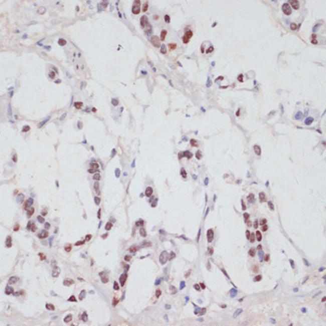 Phospho-SRF (Ser103) Antibody in Immunohistochemistry (Paraffin) (IHC (P))