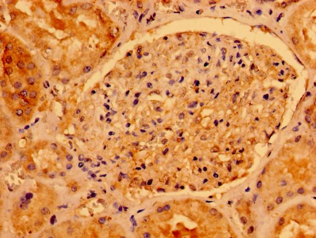 AACS Antibody in Immunohistochemistry (Paraffin) (IHC (P))