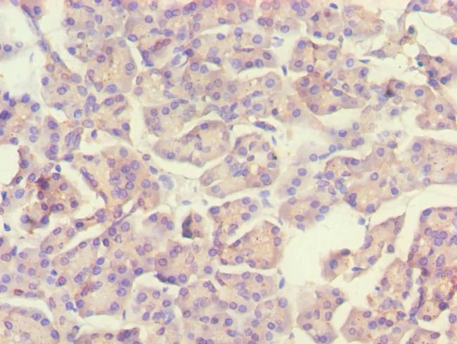 ACADS Antibody in Immunohistochemistry (Paraffin) (IHC (P))