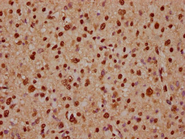 ADAR1 Antibody in Immunohistochemistry (Paraffin) (IHC (P))