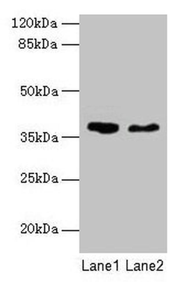 AGA Antibody in Western Blot (WB)