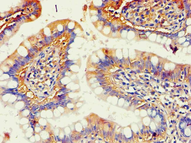 AKR1B10 Antibody in Immunohistochemistry (Paraffin) (IHC (P))