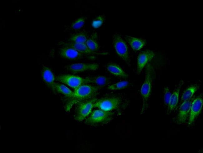 ALDH3B1 Antibody in Immunocytochemistry (ICC/IF)