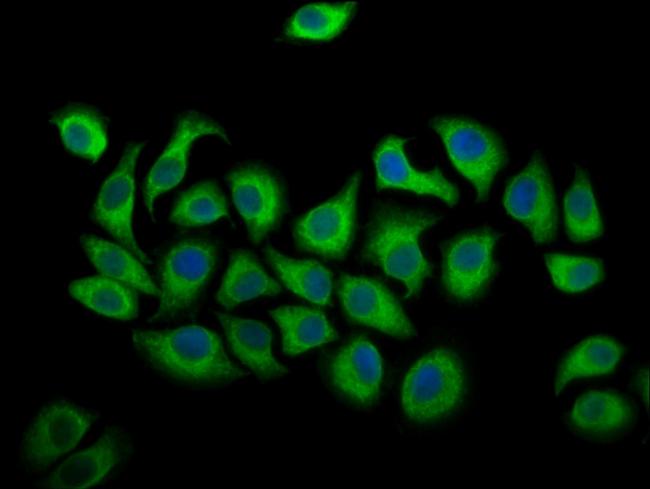 ALOX12 Antibody in Immunocytochemistry (ICC/IF)