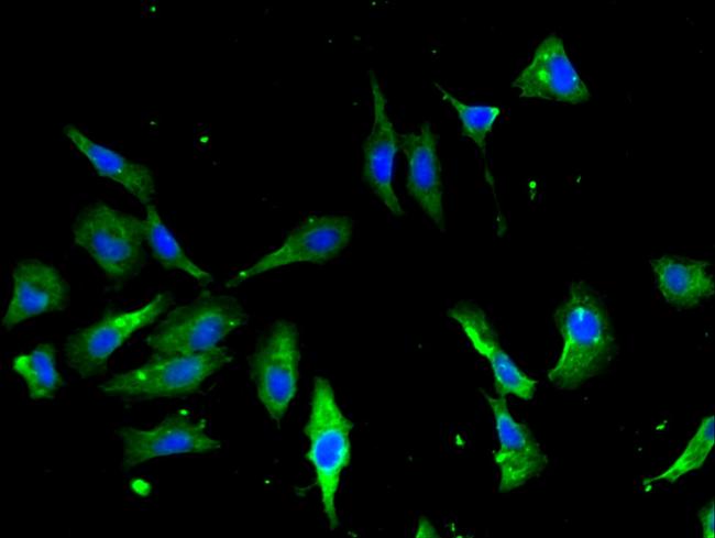 Annexin A2 Antibody in Immunocytochemistry (ICC/IF)