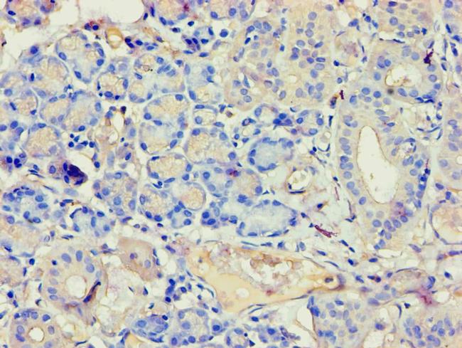 Annexin A7 Antibody in Immunohistochemistry (Paraffin) (IHC (P))