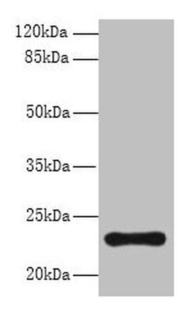 AP3S2 Antibody in Western Blot (WB)