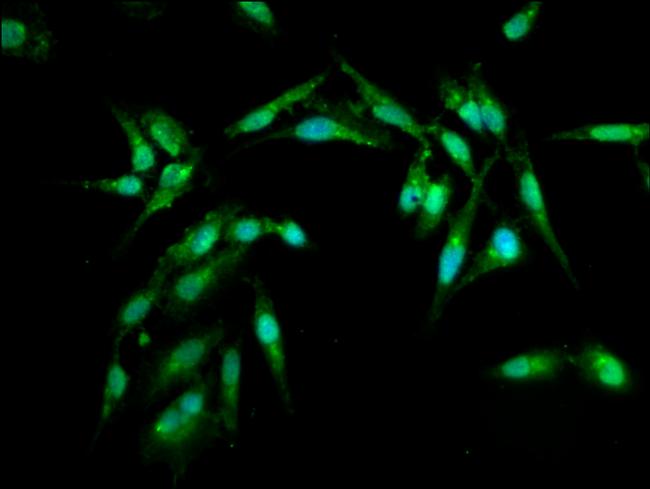 ARL1 Antibody in Immunocytochemistry (ICC/IF)