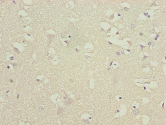 ATP5D Antibody in Immunohistochemistry (Paraffin) (IHC (P))