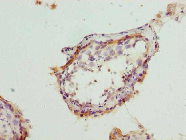 BAP29 Antibody in Immunohistochemistry (Paraffin) (IHC (P))