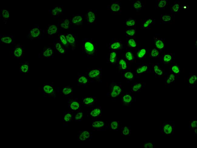 BCL9 Antibody in Immunocytochemistry (ICC/IF)