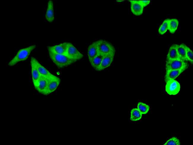 C5AR1 Antibody in Immunocytochemistry (ICC/IF)