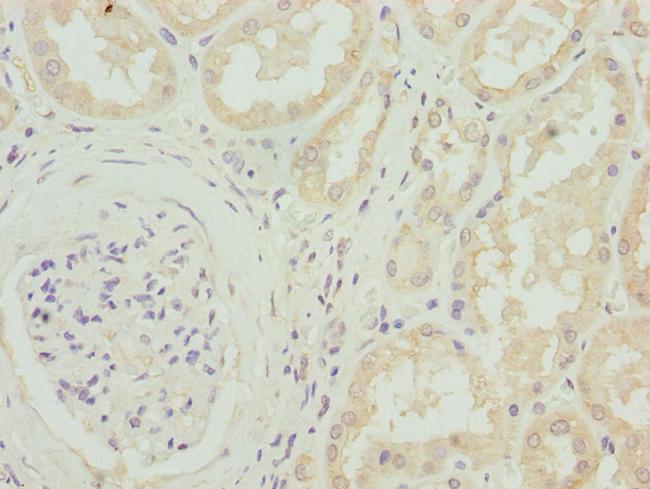 CACNB1 Antibody in Immunohistochemistry (Paraffin) (IHC (P))