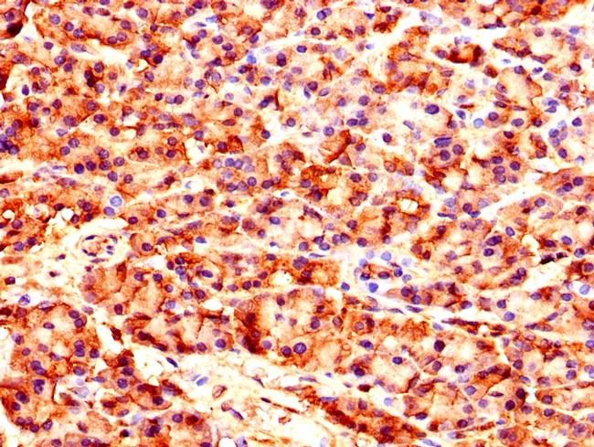 CARS Antibody in Immunohistochemistry (Paraffin) (IHC (P))