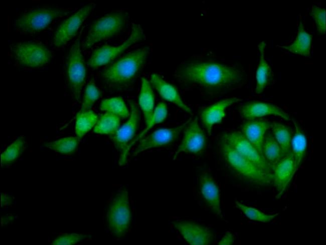 Calpastatin Antibody in Immunocytochemistry (ICC/IF)