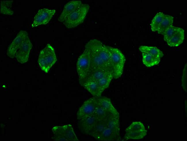 Cyclin D2 Antibody in Immunocytochemistry (ICC/IF)