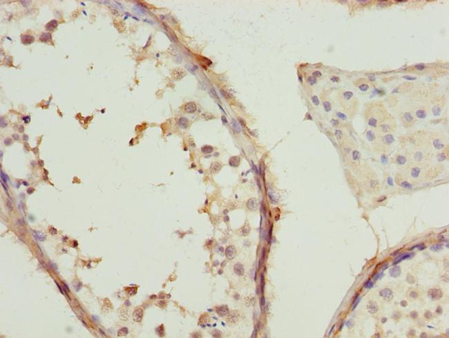 TCP-1 beta Antibody in Immunohistochemistry (Paraffin) (IHC (P))