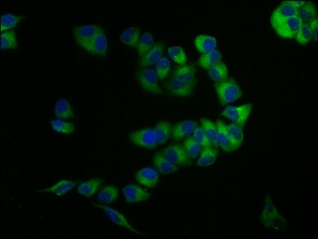 CD59 Antibody in Immunocytochemistry (ICC/IF)