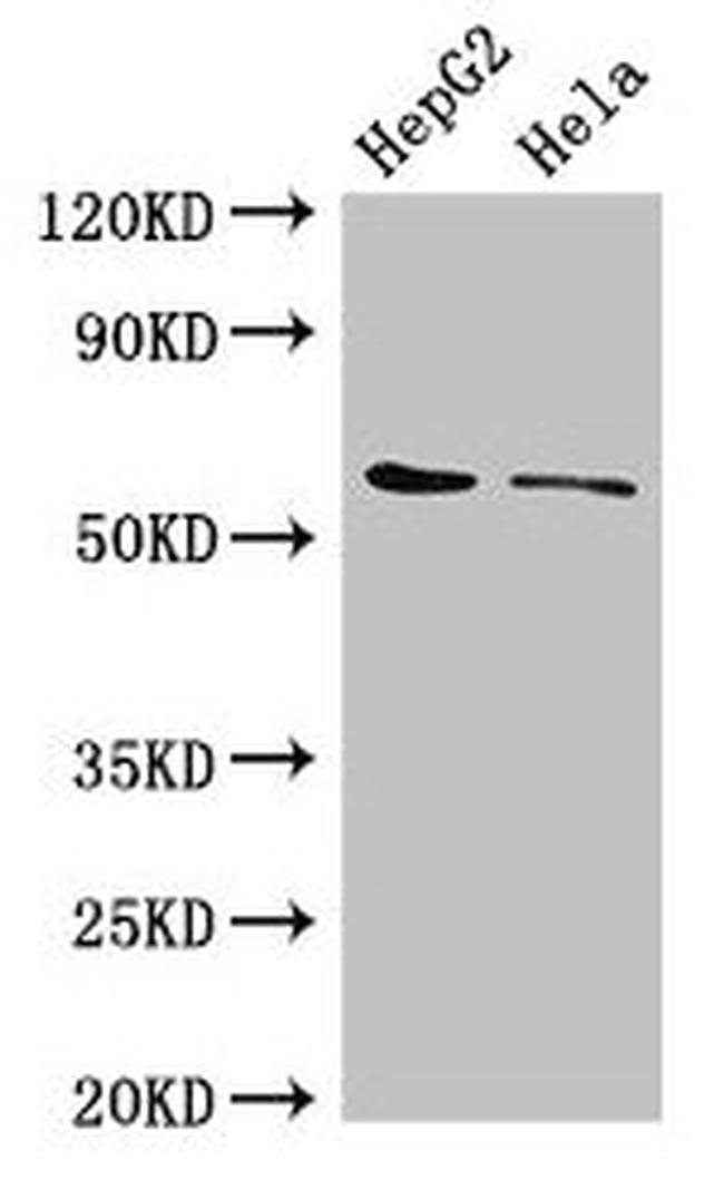 CDT1 Antibody in Western Blot (WB)