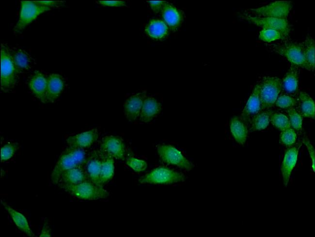 CES1 Antibody in Immunocytochemistry (ICC/IF)