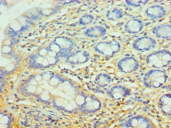 Complement Factor H Antibody in Immunohistochemistry (Paraffin) (IHC (P))