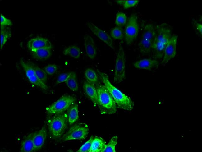 ODC1 Antibody in Immunocytochemistry (ICC/IF)