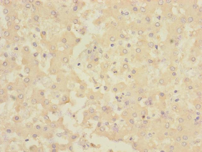 CHRNE Antibody in Immunohistochemistry (Paraffin) (IHC (P))