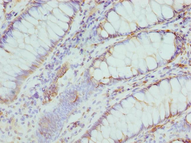 CMPK1 Antibody in Immunohistochemistry (Paraffin) (IHC (P))