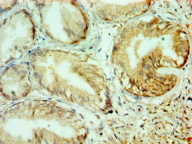 Collagen X Antibody in Immunohistochemistry (Paraffin) (IHC (P))