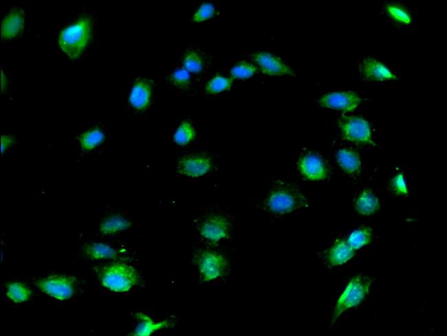 COL8A1 Antibody in Immunocytochemistry (ICC/IF)