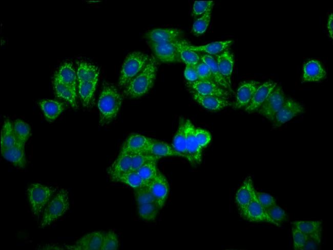 CPS1 Antibody in Immunocytochemistry (ICC/IF)