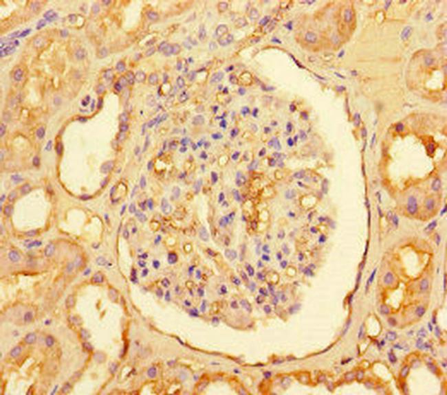 CPT1A Antibody in Immunohistochemistry (Paraffin) (IHC (P))