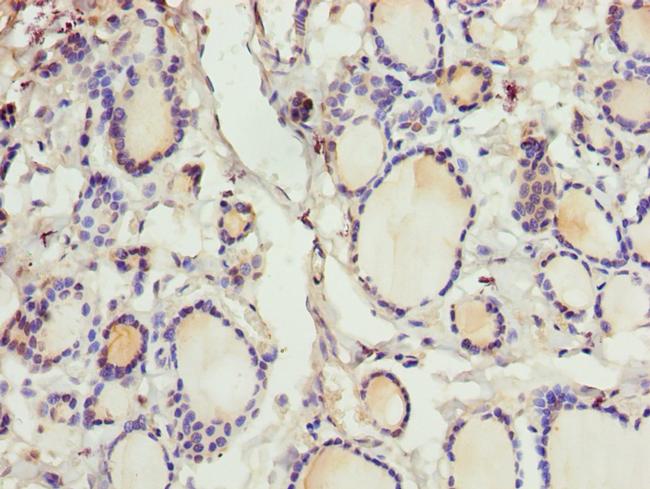 CRABP1 Antibody in Immunohistochemistry (Paraffin) (IHC (P))