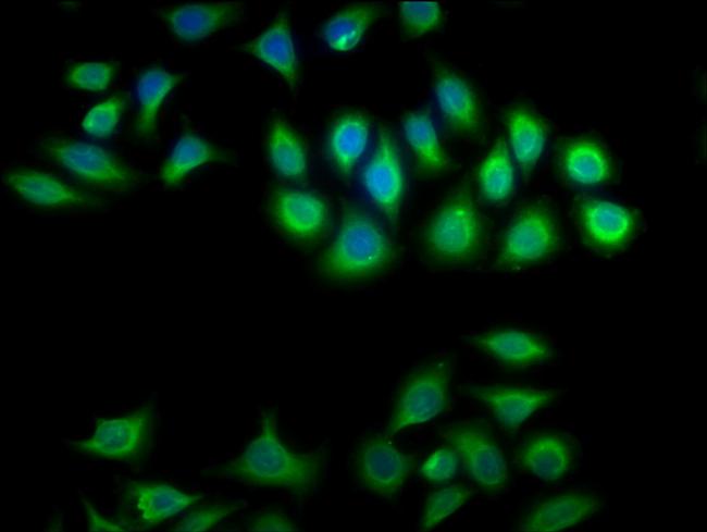 CRYBA1 Antibody in Immunocytochemistry (ICC/IF)