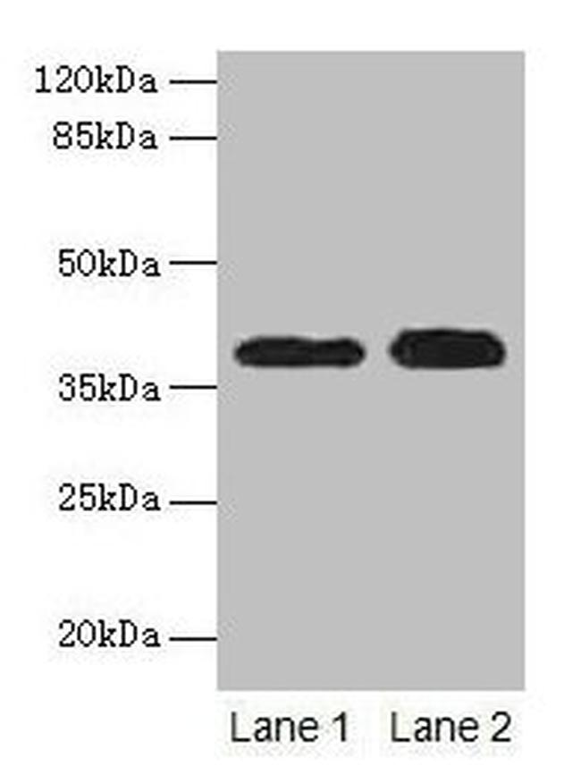 Cathepsin L Antibody in Western Blot (WB)